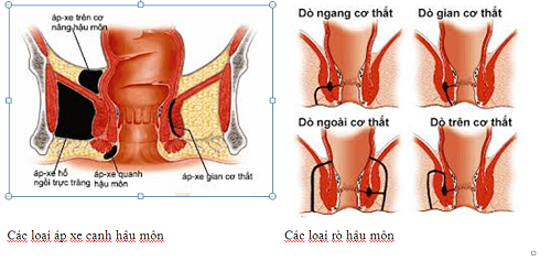 apxe hậu môn
