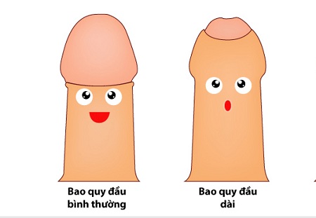 dài bao quy đầu