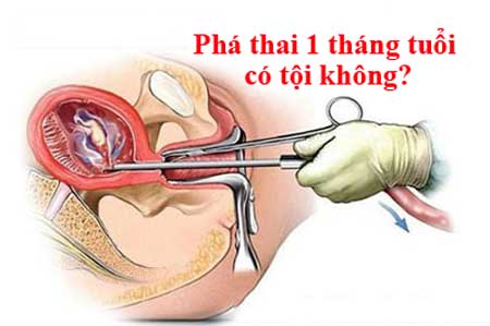 phá thai 1 tháng tuổi có tội không