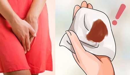 ra khí hư màu nâu