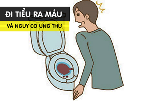 tiểu ra máu