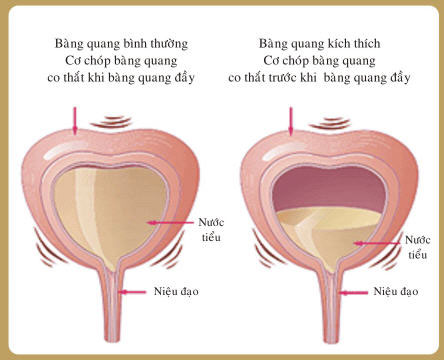 viem bang quang