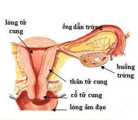 viêm ống dẫn trứng