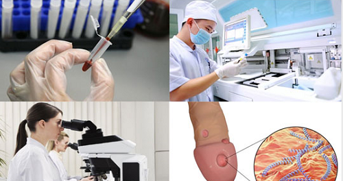 xét nghiệm máu phát hiện bệnh giang mai